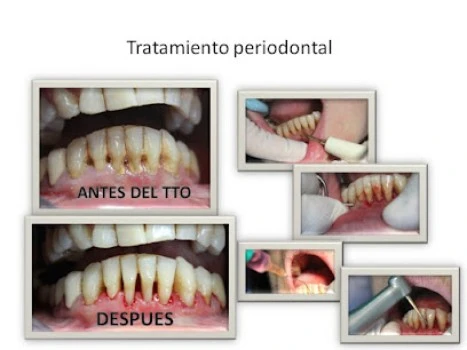CLINICA DENTAL JUAN FRANCISCO MORIANA MATA