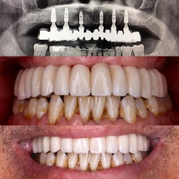 Dr. Paco Dominguez Moreno, Dentista