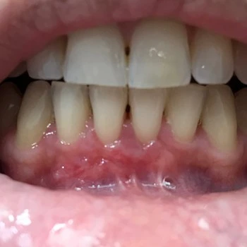 Clínica Dental Javier Pérez Morato