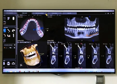 ???? Clínica Dental Dr. Pompeyo - Acueducto