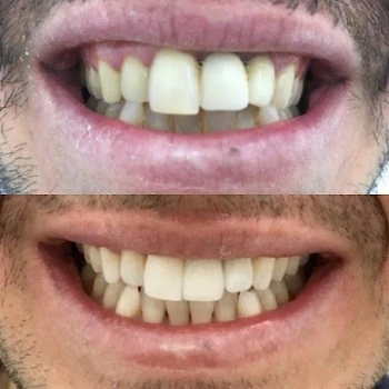 Dr. Pedro Antonio Fortuño Citoler, Dentista