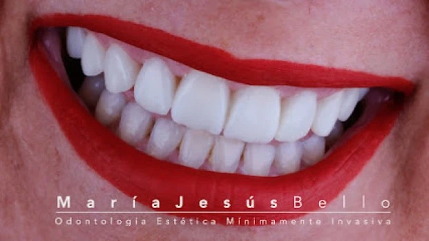 María Jesús Bello - Odontología Estética Mínimamente Invasiva