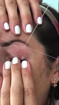 INDIBA VALENCIA - LASER VALENCIA - CAPRICHO EXPERIENCE